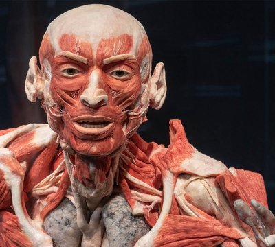 인체의 신비 박물관 '생명의 단면' (쾨르퍼벨텐 박물관 '파세텐 데스 레벤스')